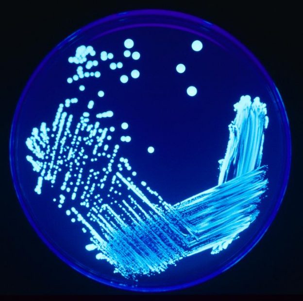 Culture de Legionella sp. sous UV©Wikipédia